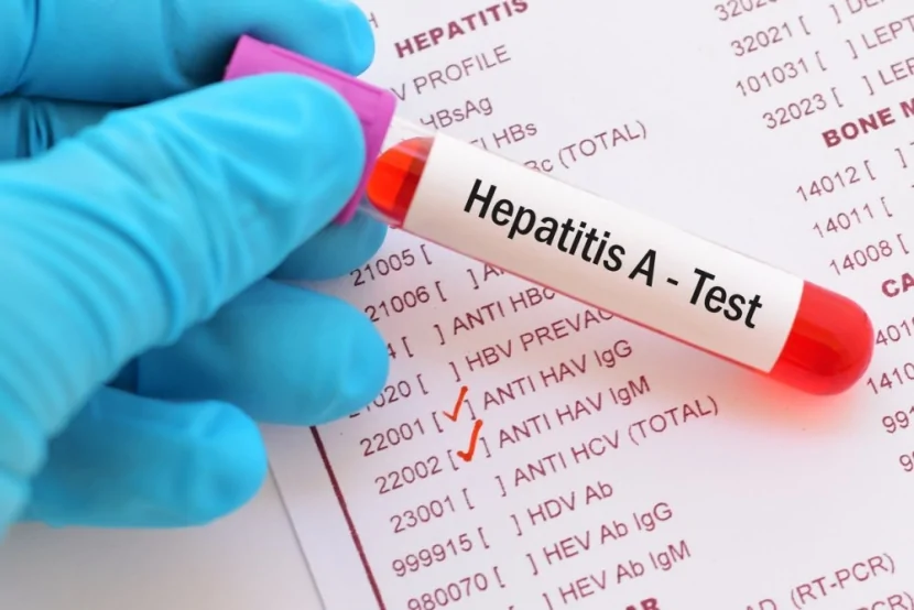 Hepatit A-ya qarşı təcili peyvəndləmə BAŞLADI - bu ölkədə