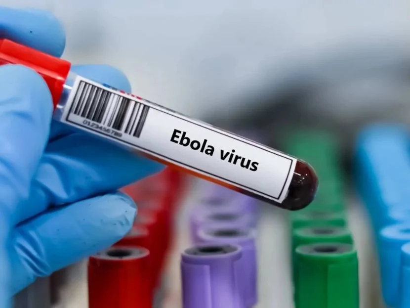 İtaliyada Ebola virusu AŞKARLANIB